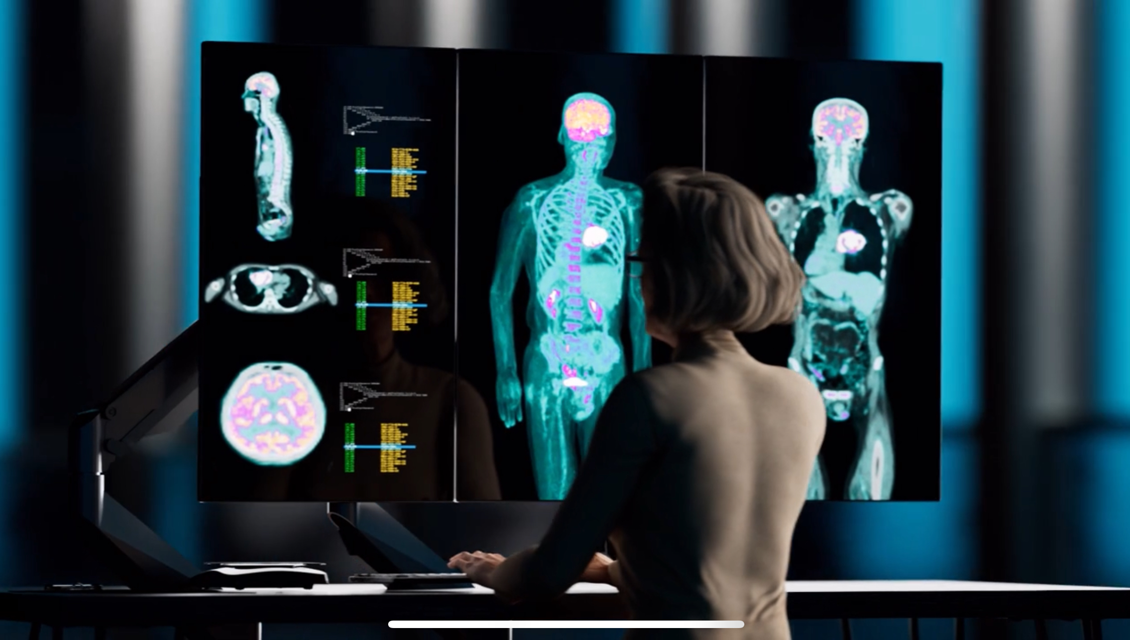 ¿Qué es un examen PET-CT? - Oncocenter